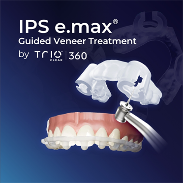 Homepage Blocks Guided Veneer Treatment