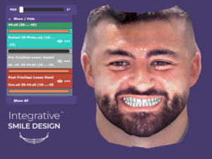 Integrative Smile Design