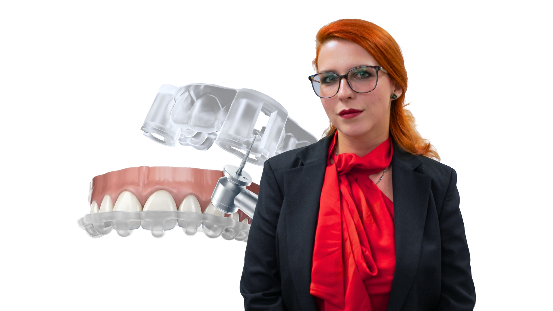 Webinar Guided Veneer Treatment Header