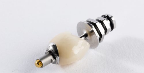 Crowns-screw-cement