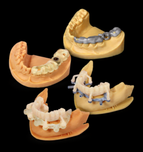 Surgical Guides