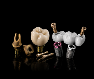 Forma® Implantaatkronen en -bruggen​